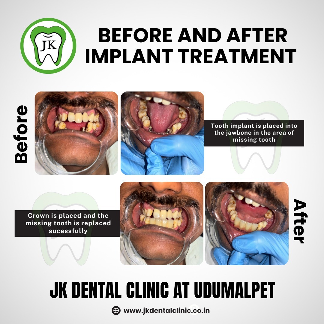 Dental Clinic Udumalpet