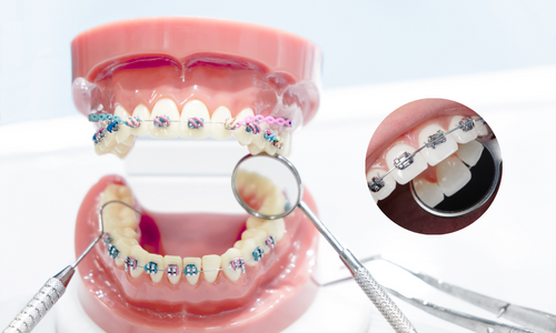 Dental Orthodontic in Udumalpet