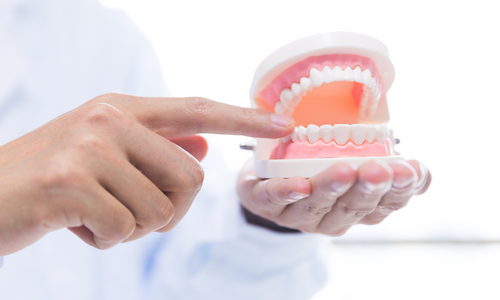 Full Mouth Rehabilitation in Udumalpet